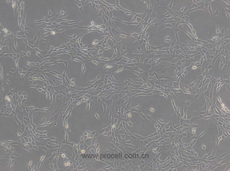 NIH/3T3 (小鼠胚胎细胞) (STR鉴定正确)