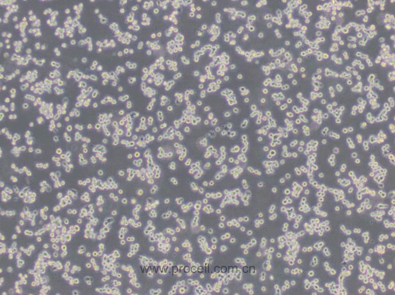 NR8383 [AgC11x3A; NR8383.1] (大鼠肺泡巨噬细胞) (种属鉴定正确)