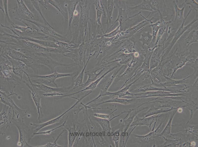 OP9 (小鼠骨髓基质细胞) (STR鉴定正确)