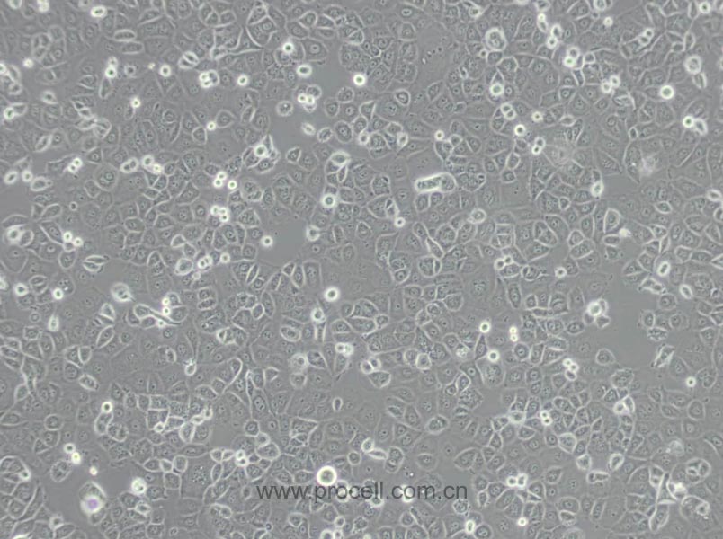 NIH:OVCAR-3 [OVCAR3] (人卵巢癌细胞) (STR鉴定正确)