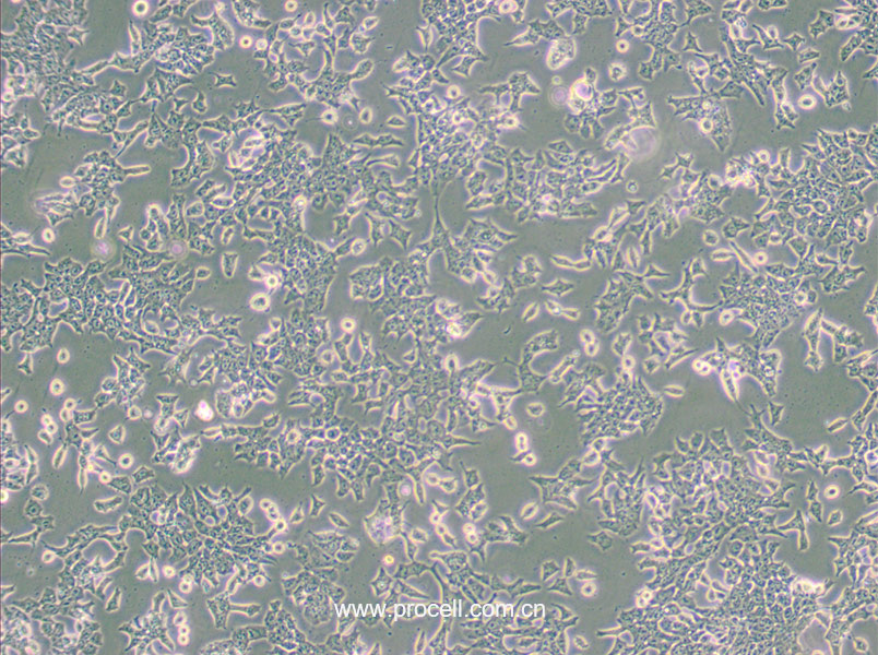P19 [P-19] (小鼠畸胎瘤细胞) (种属鉴定正确)