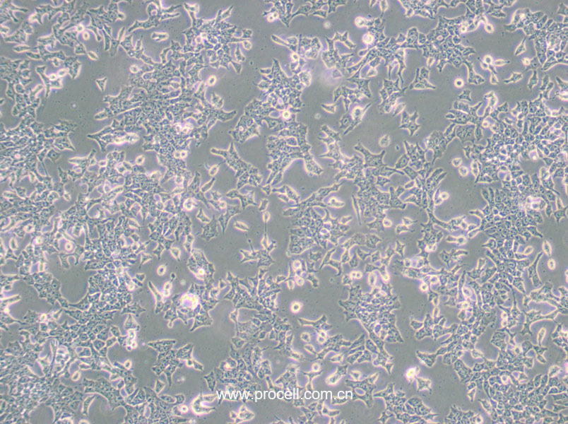P19 [P-19] (小鼠畸胎瘤细胞) (STR鉴定正确)