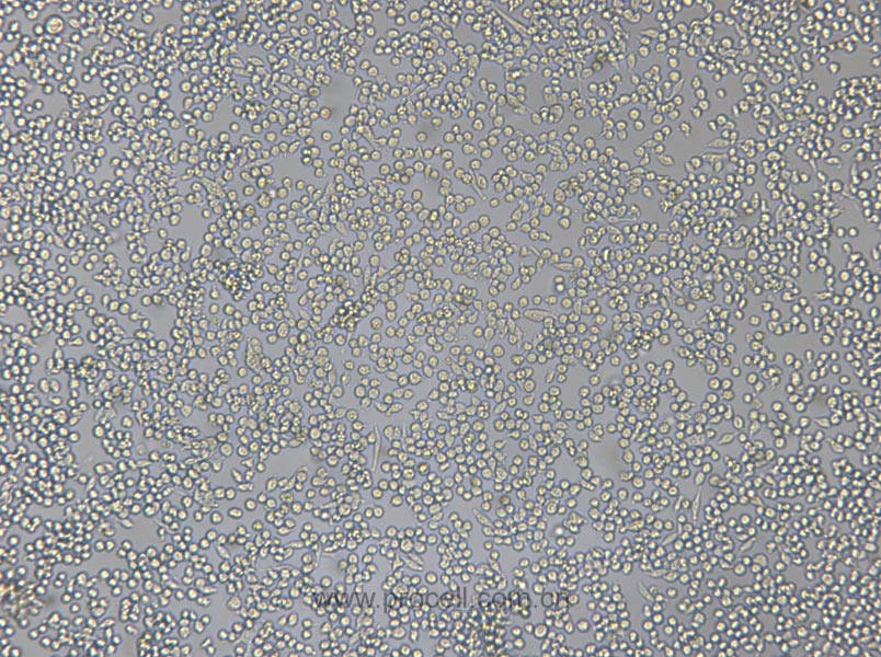 P815 (小鼠肥大细胞瘤细胞) (种属鉴定正确)