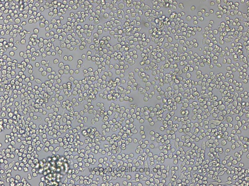 P815 (小鼠肥大细胞瘤细胞) (种属鉴定正确)