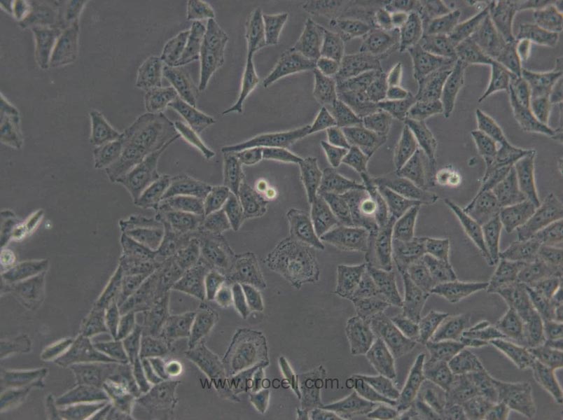 QGY-7701 (人肝癌细胞) (Hela污染细胞系，暂不供应)
