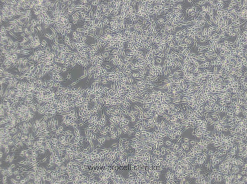 RBL-2H3 (大鼠嗜碱性细胞白血病细胞) (种属鉴定正确)