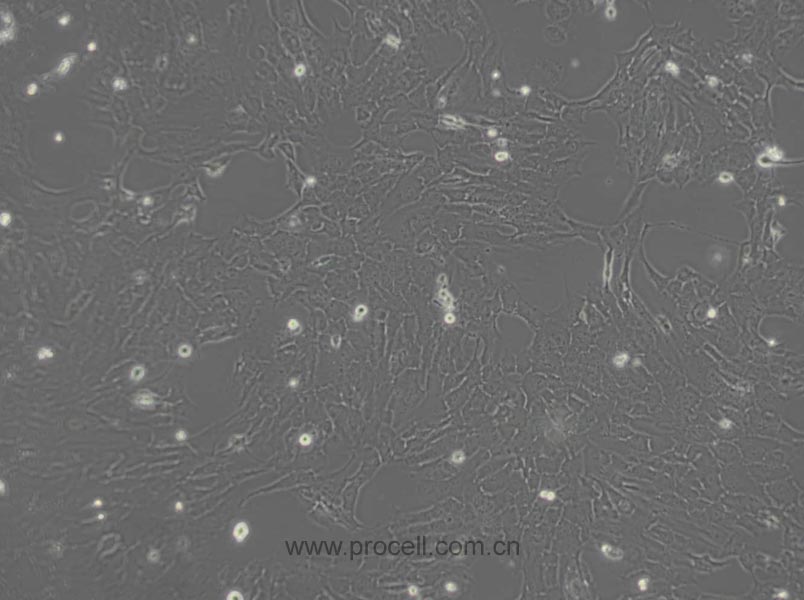 RF/6A (猴脉络膜-视网膜内皮细胞)