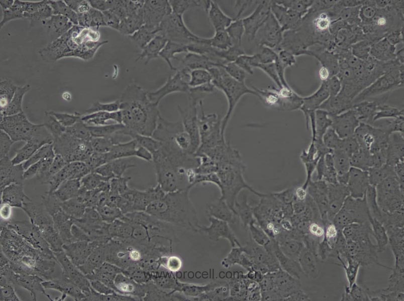 RF/6A (猴脉络膜-视网膜内皮细胞)