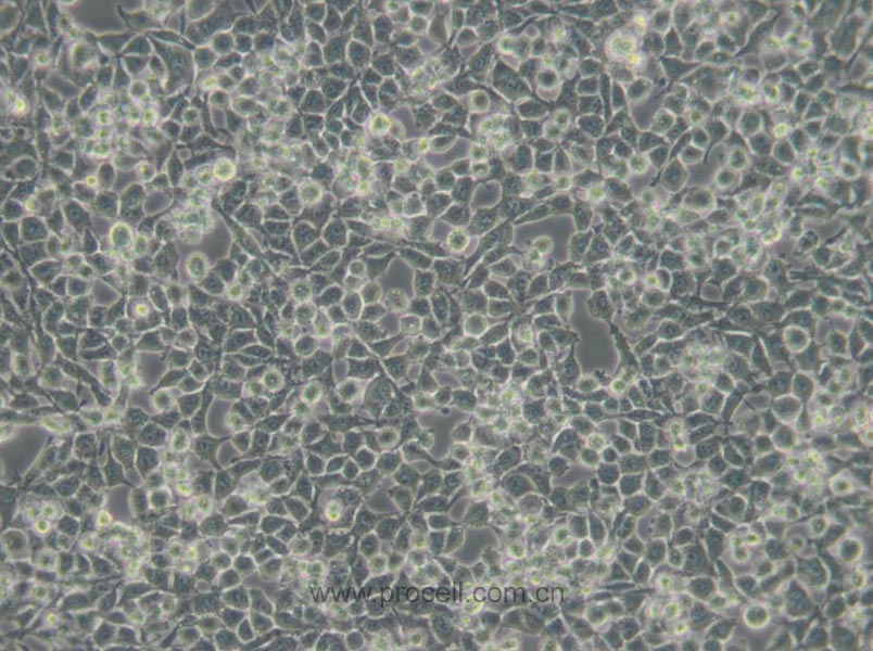 RSC96 (大鼠雪旺细胞) (种属鉴定正确)