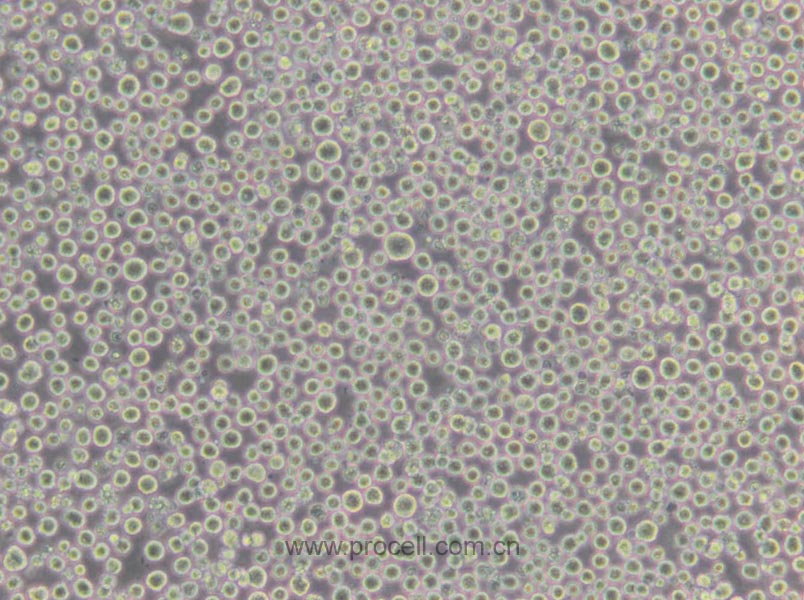S-180 (小鼠腹水瘤细胞) (种属鉴定正确)