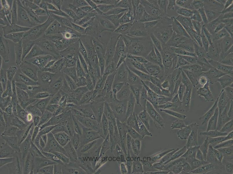 Saos-2 (人成骨肉瘤细胞) (STR鉴定正确)