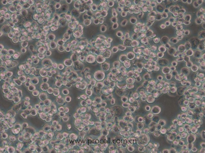 Sf21 (昆虫卵巢细胞) (种属鉴定正确)