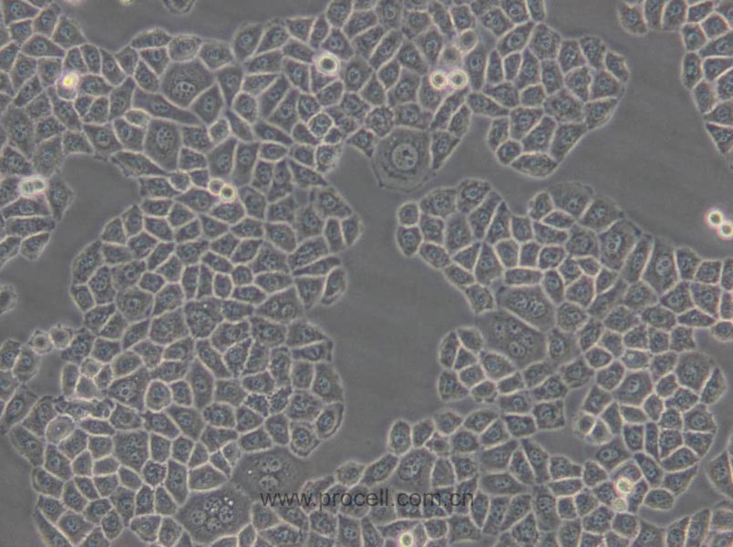 SPC-A-1 (人肺腺癌细胞) (Hela污染细胞系，暂不供应)