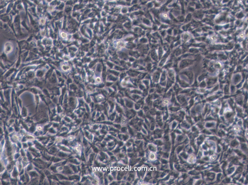 STO (小鼠胚成纤维细胞) (STR鉴定正确)