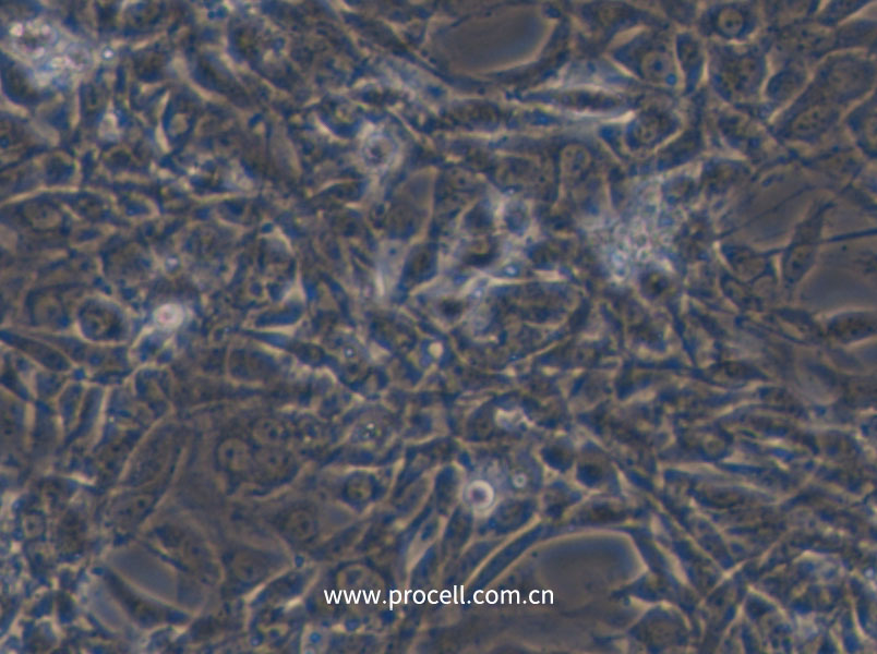 STO (小鼠胚成纤维细胞) (STR鉴定正确)