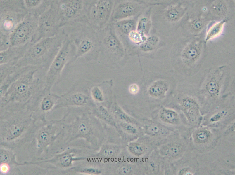 SVEC4-10 (小鼠淋巴结内皮细胞) (种属鉴定正确)