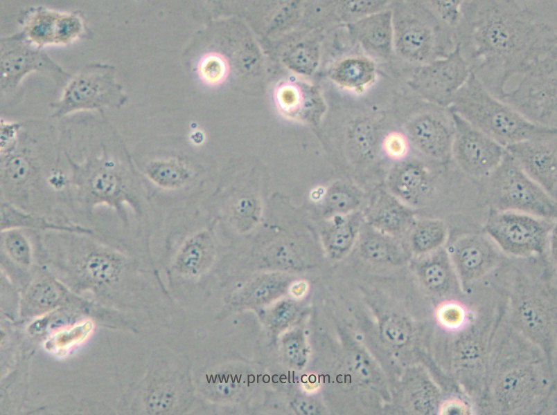 SVEC4-10 (小鼠淋巴结内皮细胞) (种属鉴定正确)
