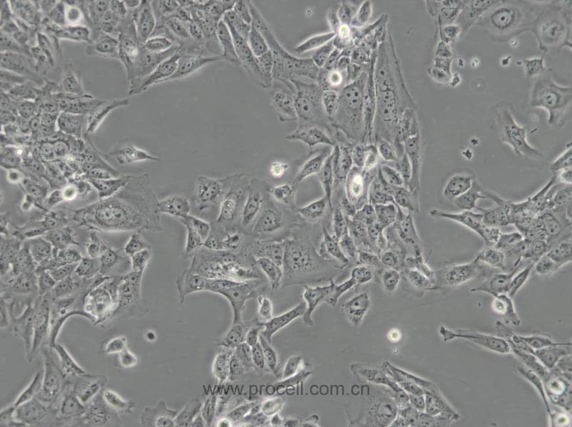 SV-HUC-1 (人输尿管上皮永生化细胞) (STR鉴定正确)