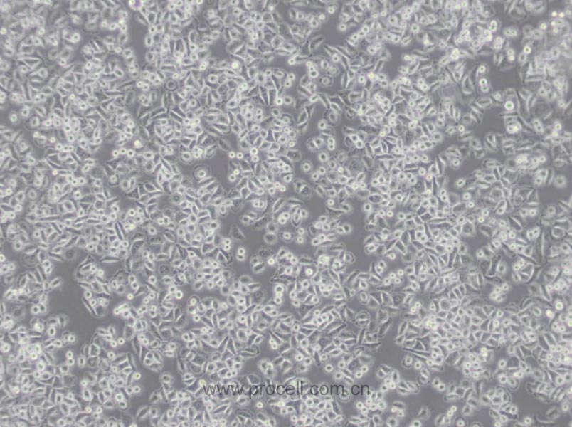 Tca-8113 (人舌鳞癌细胞) (Hela污染细胞系，暂不供应)