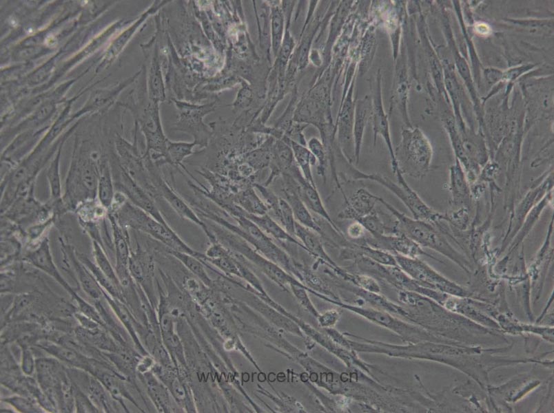 WI-38 (人胚肺细胞) (STR鉴定正确) (暂不出售)