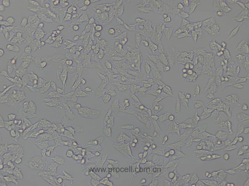 Y1 [Y-1] (小鼠肾上腺皮质瘤细胞) (种属鉴定正确)