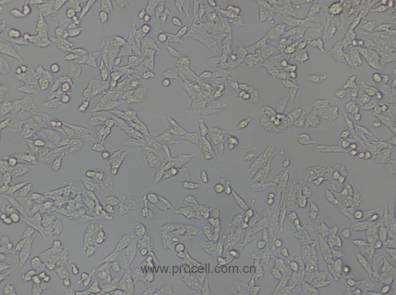 Y1 [Y-1] (小鼠肾上腺皮质瘤细胞) (种属鉴定正确)