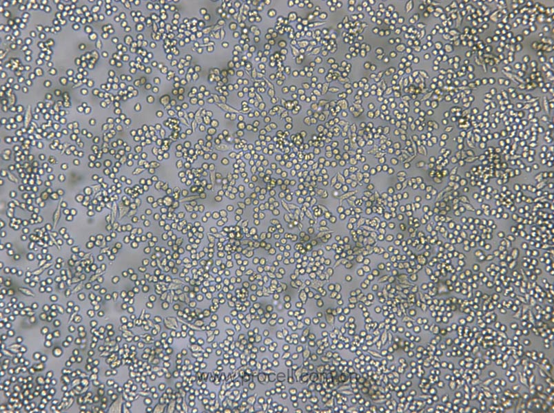 L6565 (小鼠白血病克隆细胞系) (种属鉴定正确)