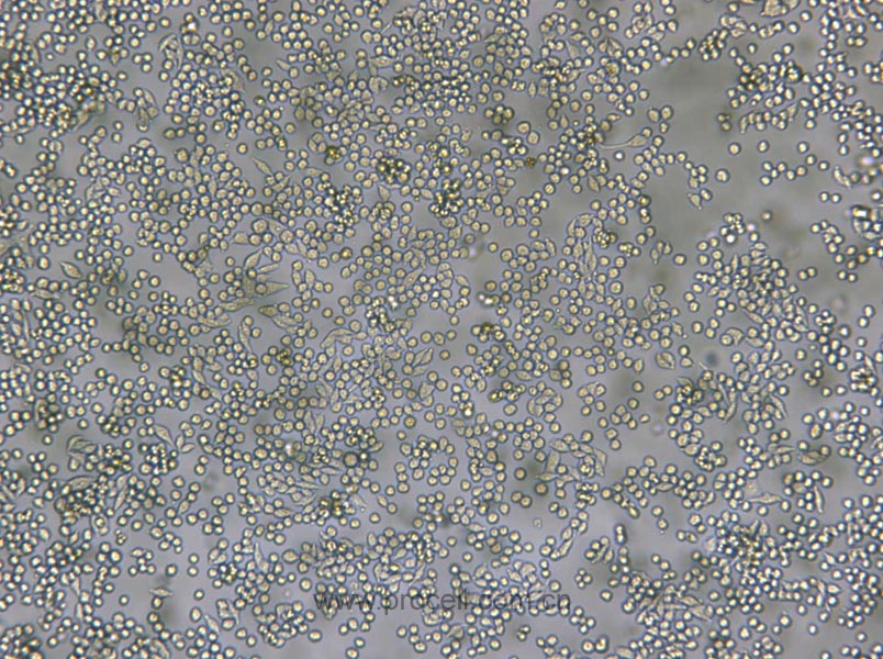 L6565 (小鼠白血病克隆细胞系) (种属鉴定正确)
