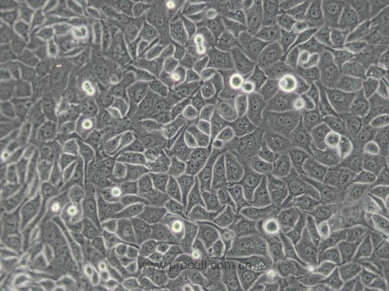 CNE-2Z (人鼻咽癌细胞) (Hela污染细胞系，暂不供应)