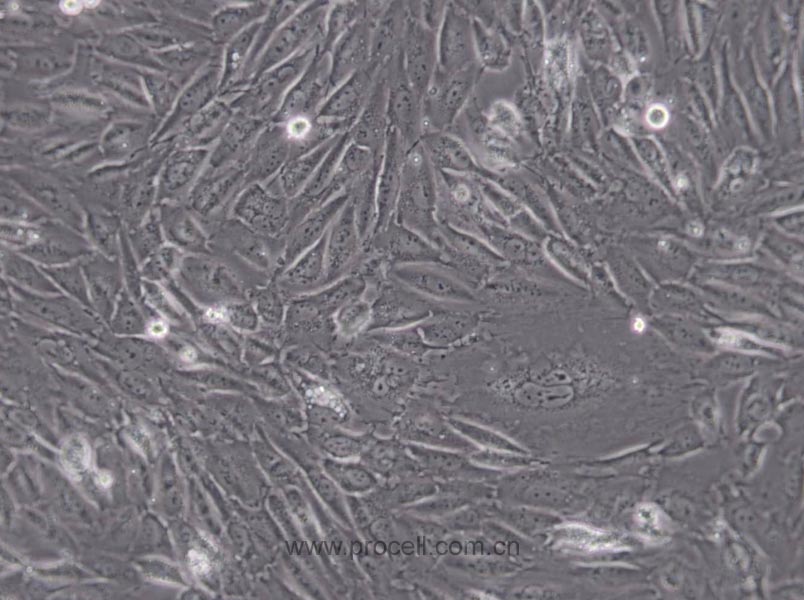 EA.hy926 (人脐静脉细胞融合细胞) (STR鉴定正确)