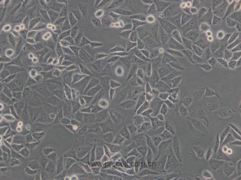 EJ-1 (人膀胱癌细胞) (T24污染细胞系，暂不供应)