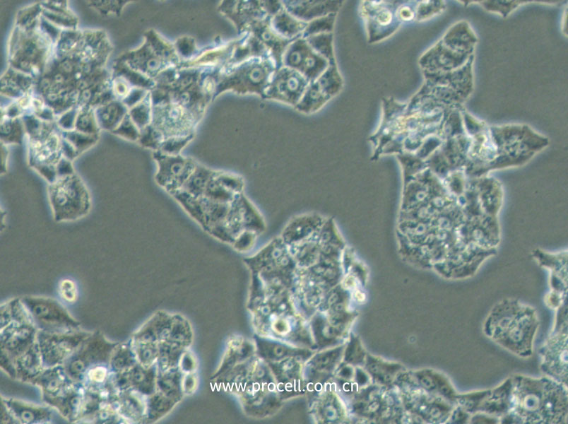 NCI-H1395 (人肺腺癌细胞) (STR鉴定正确)