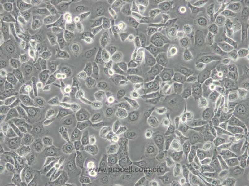 HCC 94 [HCC941122] (人子宫鳞癌细胞(高分化)) (STR鉴定正确)