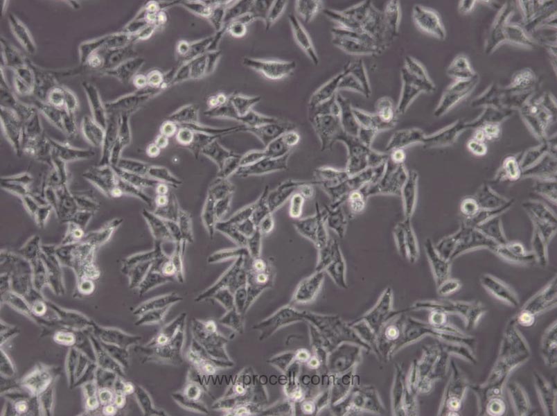 MDA-MB-435 (人乳腺癌高转移细胞) (M14污染细胞系，暂不供应)