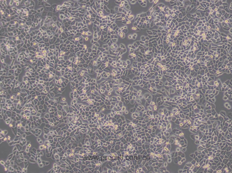 MDA-MB-468 (人乳腺癌细胞) (STR鉴定正确)