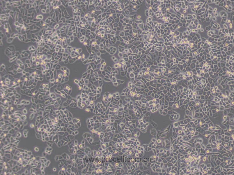 MDA-MB-468 (人乳腺癌细胞) （L15） (STR鉴定正确)