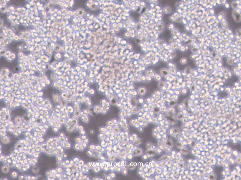 Y3-Ag 1.2.3 (大鼠骨髓瘤细胞) (种属鉴定正确)