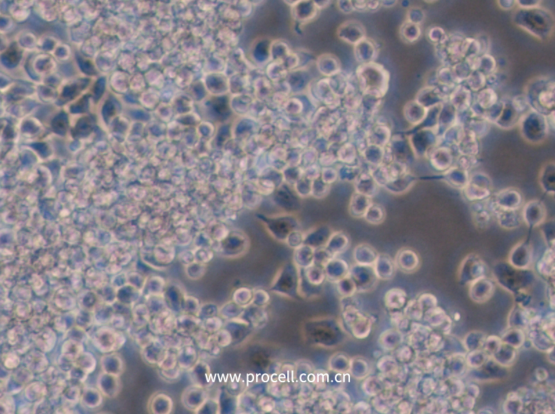 Y3-Ag 1.2.3 (大鼠骨髓瘤细胞) (种属鉴定正确)
