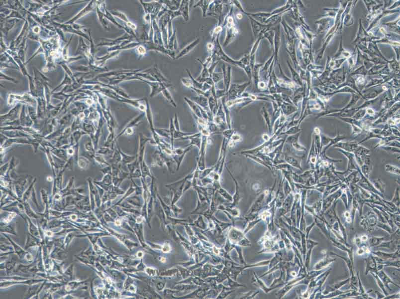 NCI-H1975 (人肺腺癌细胞) (STR鉴定正确)