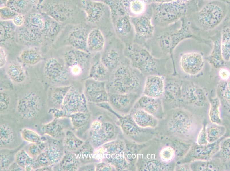 NCI-H661 (人大细胞肺癌细胞) (STR鉴定正确)