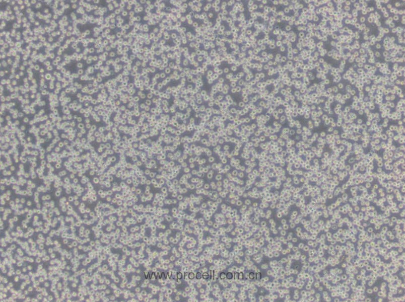 M-NFS-60 [NFS-60] (小鼠髓性白血病淋巴细胞/小鼠白血病G-CSF依赖性细胞) (种属鉴定正确)