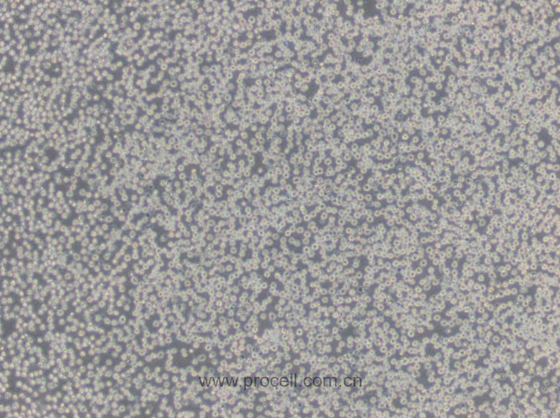 NFS-60 (小鼠髓性白血病淋巴细胞) (STR鉴定正确)