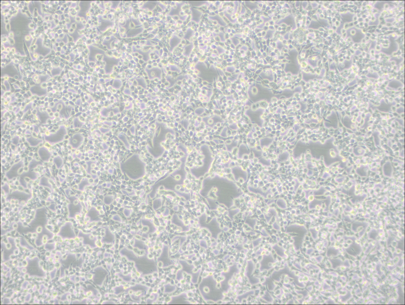 293E (人胚肾细胞(EBNA1基因修饰))(STR鉴定正确)