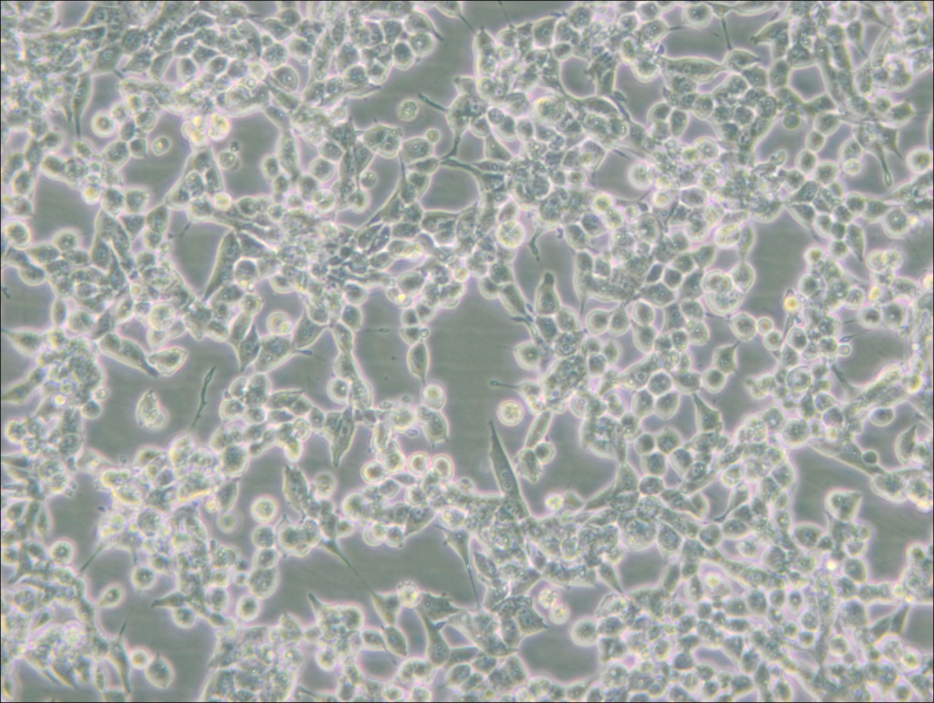 293E (人胚肾细胞(EBNA1基因修饰))(STR鉴定正确)