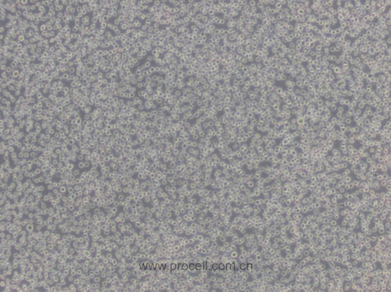 Jurkat clone A3[A3] (人T淋巴细胞白血病细胞) (STR鉴定正确)