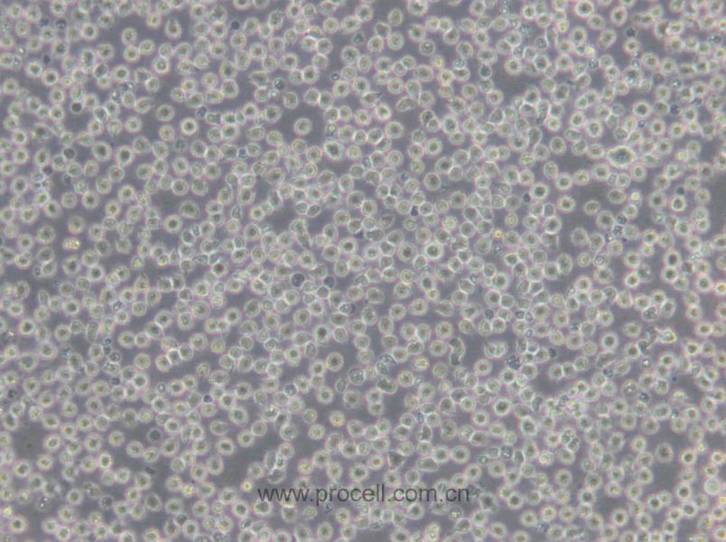 Jurkat clone A3[A3] (人T淋巴细胞白血病细胞) (STR鉴定正确)