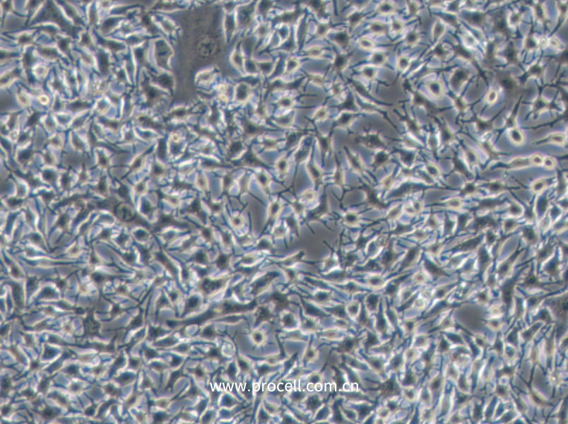 B16-F1 (小鼠黑色素瘤细胞) (STR鉴定正确)