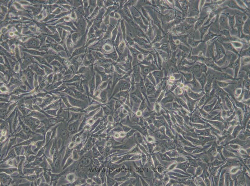 B16-F10 (小鼠皮肤黑色素瘤细胞) (STR鉴定正确)