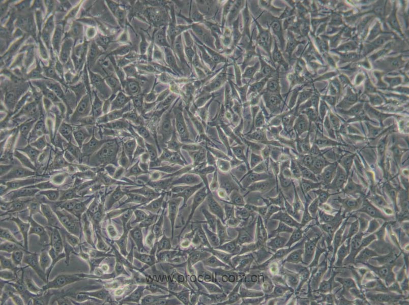B16-F10 (小鼠皮肤黑色素瘤细胞) (STR鉴定正确)