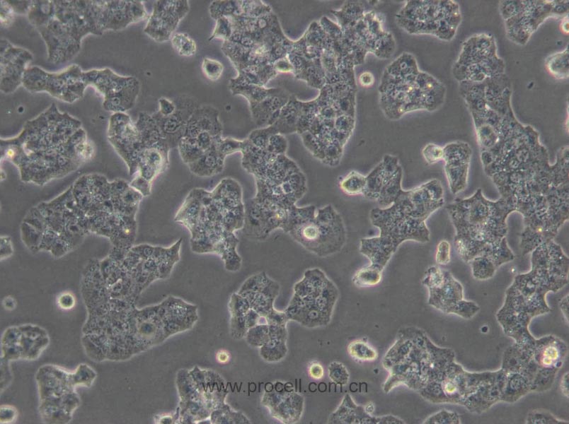 Beta-TC-6 (小鼠胰岛素瘤胰岛β细胞) (STR鉴定正确)